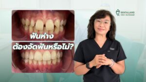 Gap between teeth Do I need braces?